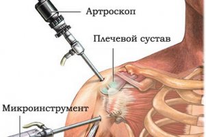 Своевременная диагностика остеоартроза и ее особенности
