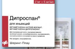 Можно ли крутить обруч при заболевании коксартроз?