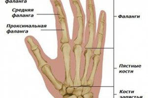 Артрит пальцев рук: лечение народными средствами