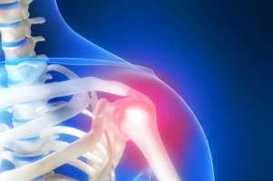 Что представляет собой остеоартроз акромиально-ключичного сочленения