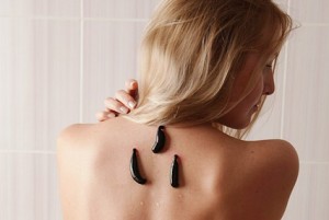 гирудотерапия